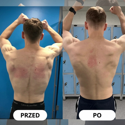 Posturex™ – korektor postawy dla prostych pleców i codziennego komfortu
